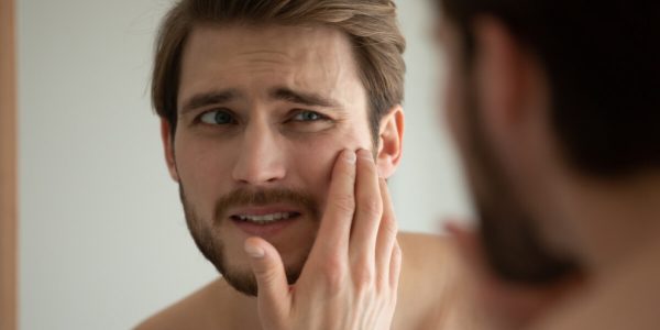 5 Ways To Stop Men’s Oily Skin