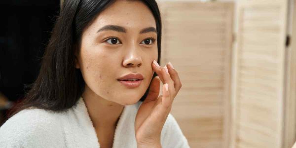 skincare target market for Acne-Prone Skin